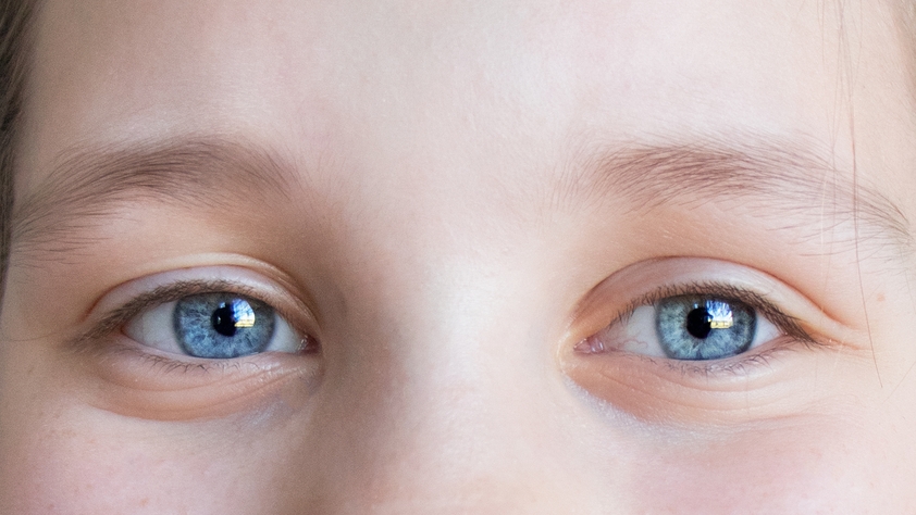 Plavooka devojčica sa stabizmom